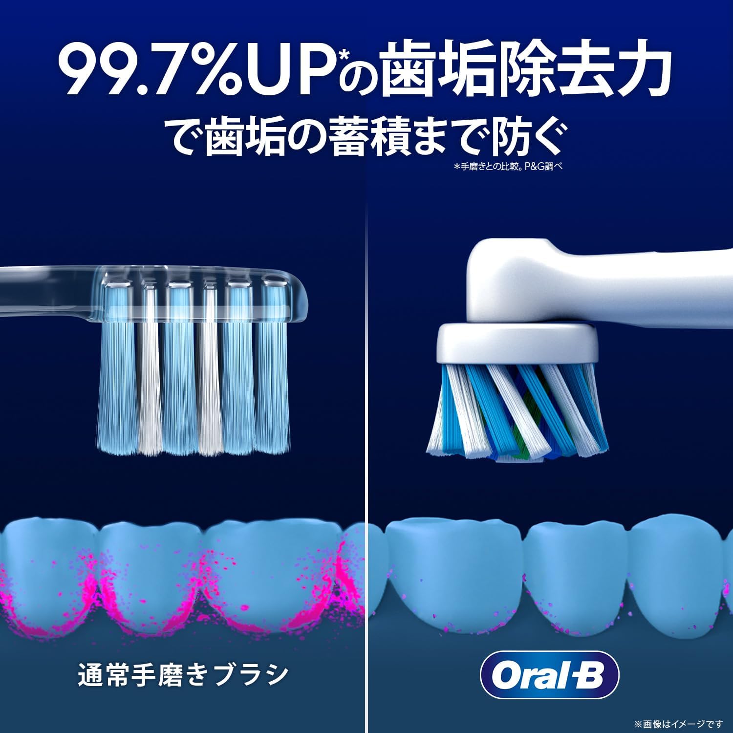 P&G- Bàn chải điện OralB Sumizumi loại đa tác động